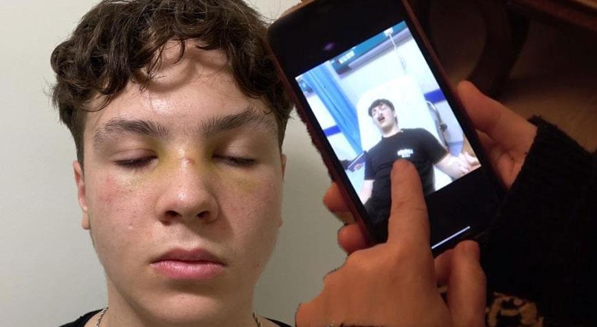 Lise çıkışında dehşett! 15 kişi 14 yaşındaki öğrencinin burnunu kırdı