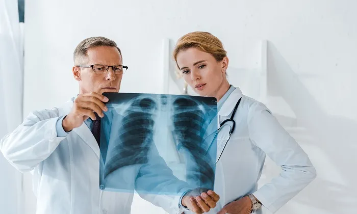 Akciğer Kanseri Nedir? Akciğer Kanseri Tedavisi